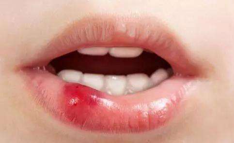 2023銅仁治療酒糟鼻top10強(qiáng)的專家(肖鈺柱、劉大琨、龔武斌從評價看挺正規(guī))