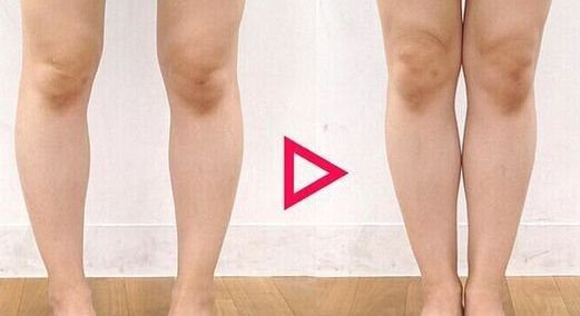 南昌二附院整形科腰腹吸脂是否可靠？醫(yī)生專業(yè)解讀幫您解答