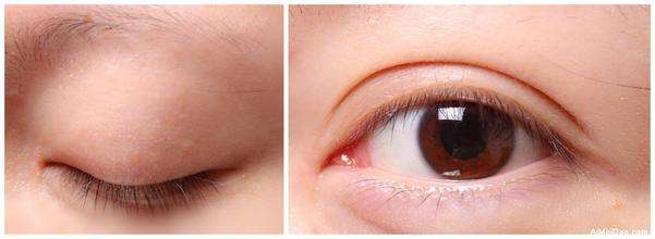 2023蚌埠面部共振吸脂瘦臉權(quán)威專家排名榜前10名(徐靜、李準馥、官赳駒專家技術(shù)點評出爐)