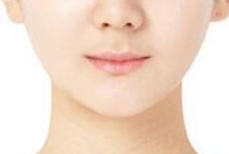 上海第九人民醫(yī)院李圣利：坐診時(shí)間、醫(yī)生簡(jiǎn)介與雙眼皮案例介紹