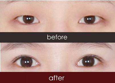 2023濟寧激光除眼底紋權(quán)威專家評價TOP10強(郝昭華、宋成、李華榜前三毫無懸念)