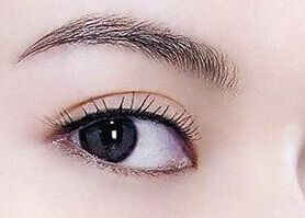 南充去眼袋哪家醫(yī)院好？專家推薦解決眼袋困擾的南充醫(yī)院排行榜