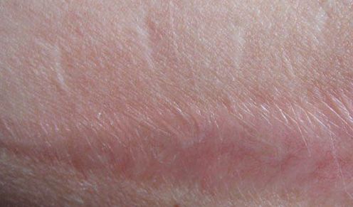 嘉興有哪些專業(yè)的醫(yī)美機(jī)構(gòu)提供雙眼皮手術(shù)？