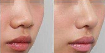 溫州和平整形醫(yī)院有哪些主要項(xiàng)目呢？