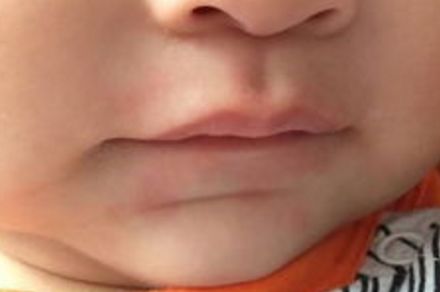 天津星和醫(yī)療美容門診怎么樣？天津星和醫(yī)療美容門診簡介|醫(yī)生團(tuán)隊|口碑評價！