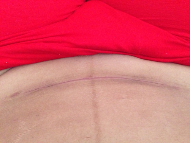 郭祥文雙眼皮風(fēng)格揭秘，醫(yī)生經(jīng)歷與精美案例分享