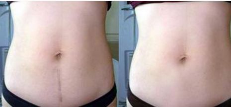 成都眼袋整形醫(yī)院哪家好？選擇專業(yè)整形醫(yī)院護你年輕無眼袋