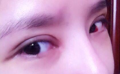 2023北京注射填充豐鼻唇溝正規(guī)醫(yī)生評(píng)分前十名(劉艷林、謝永學(xué)、李芳品牌醫(yī)美正規(guī)且專業(yè))