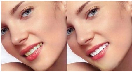 樸正國正頜手術(shù)有哪些風(fēng)格審美？