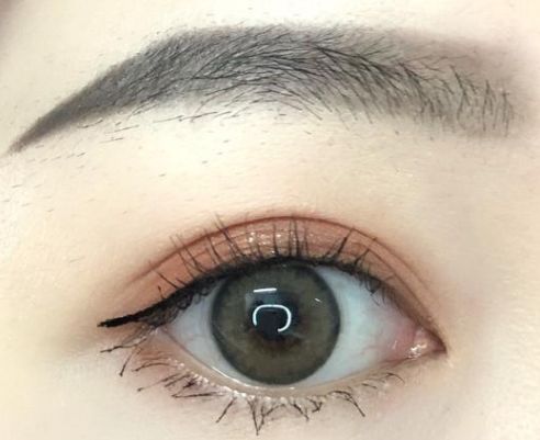 成都哪家美容醫(yī)院的埋線減肥效果好？