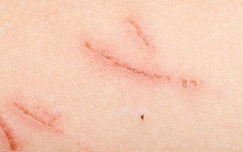 成都哪個(gè)醫(yī)院做唇整形效果好？