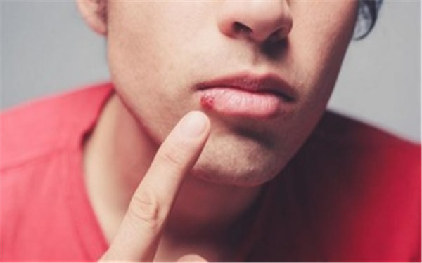 2023石家莊做c8激光祛斑口碑榜前十位的醫(yī)生(王鵬、張鴻超、張暖都是人氣醫(yī)美top)