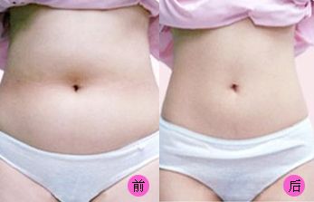 【2023吉林雙眼皮手術(shù)評(píng)測(cè)】哪家醫(yī)院值得信賴？