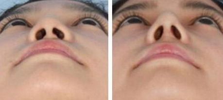 衢州做小手術(shù)哪家醫(yī)院好？快速推薦衢州當(dāng)?shù)貙I(yè)的醫(yī)院