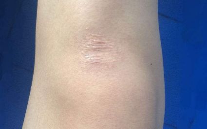 ?？诔暼パ鄞罴堰x擇有哪些？評價最好的醫(yī)療機構(gòu)大揭秘！