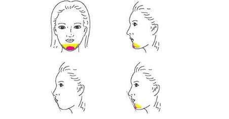 王大太的鼻子整形效果怎么樣？醫(yī)生是哪里的？技術(shù)水平如何？坐診醫(yī)院及當(dāng)?shù)貓?bào)價(jià)揭秘