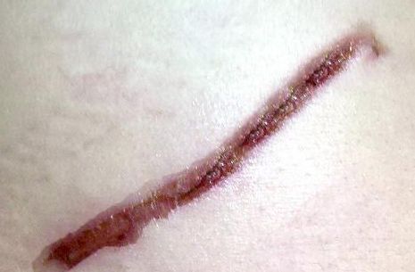 成都去法令紋哪家醫(yī)院好？找到適合你的放心醫(yī)院