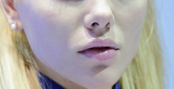 2023烏魯木齊肚子射頻溶脂在榜名單前十位醫(yī)生(劉艷、洪喬茵、張弘業(yè)讓整形更有保障)