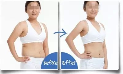 2023成都抽脂隆胸整形上榜清單前十名專家(秦曉、鄧兵、賈映缽價(jià)格不貴口碑好)