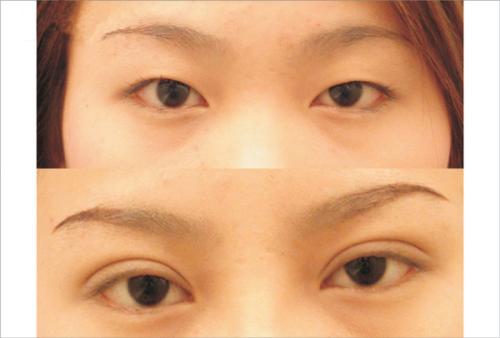 2023合肥水動(dòng)力吸脂瘦肚子10強(qiáng)醫(yī)生(朱德剛、孫洋、徐泓實(shí)力口碑滿分！)