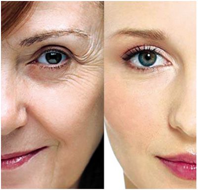 上海哪家醫(yī)院做去眼袋手術(shù)效果好？