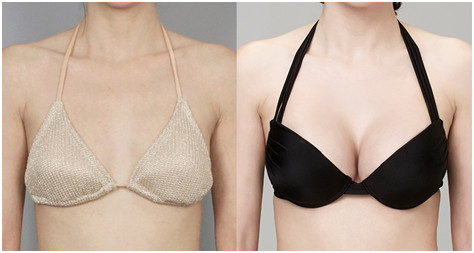 上海杜園園-專業(yè)修復雙眼皮，眼整形教授強勢推薦！附案例，讓您放心選擇！