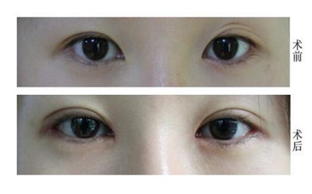 天津修復(fù)唇腭裂的醫(yī)院哪家好？專業(yè)解讀！