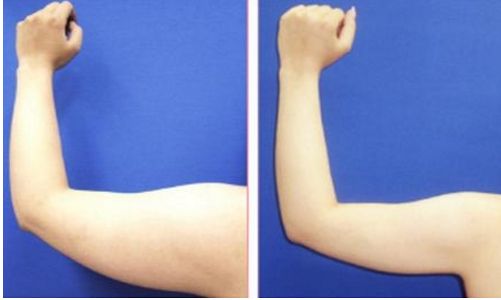 重慶整形美容醫(yī)院哪家好？最權(quán)威的整形美容醫(yī)院盤(pán)點(diǎn)