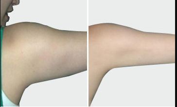 上海中國去疤痕醫(yī)院哪家好？高效去除疤痕的專業(yè)醫(yī)院推薦