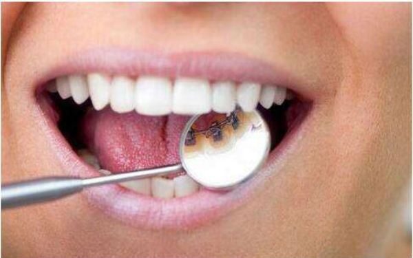 2023南寧可麗金膠原蛋白微針前10強(qiáng)醫(yī)生排行(李小慶、彭鎏、鄧皓畇技術(shù)全面升級(jí))