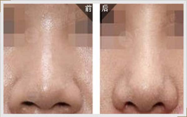 2023濟南私密年輕化正規(guī)醫(yī)生口碑十強(王召東、王鳳英、王禛禛醫(yī)美TOP遍布一線城市)