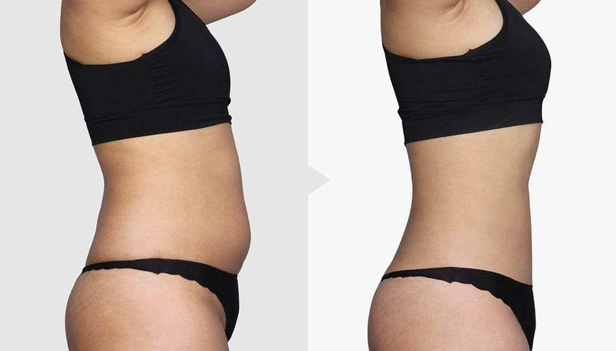 2023杭州手術(shù)除黑痣正規(guī)醫(yī)生排行榜前10名(林萍、鄭曉飛、彭濤口碑好，放心選！)