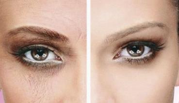 2023常德填充額頭口碑排行前十醫(yī)生(盧開銳、常剛、顧陸健收費合理不推銷)