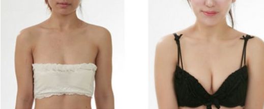 大連市做雙眼皮哪家好？了解大連市雙眼皮手術的費用、效果和口碑