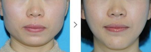 深圳哪家去色斑醫(yī)院好？專家推薦這些知名醫(yī)療機構(gòu)