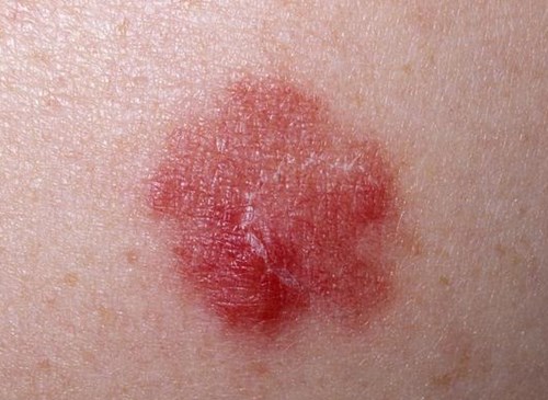 北京鼻修復(fù)醫(yī)生評價：劉彥軍、薛軼群技術(shù)對比，附價格一覽