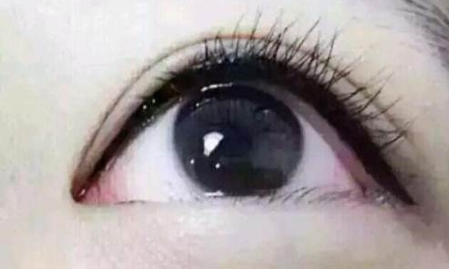 廣州曙光醫(yī)學(xué)美容醫(yī)院的黎凍抗衰老療法有多出色？