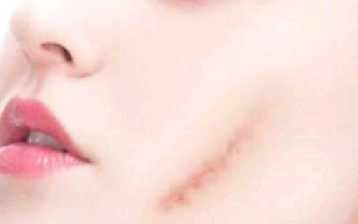 濰坊哪家醫(yī)院做抽脂整形好，服務(wù)好口碑好？