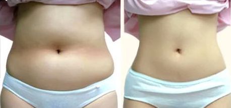 上海哪家醫(yī)院做美容手術(shù)好？——選擇上海做美容手術(shù)醫(yī)院的首選方案