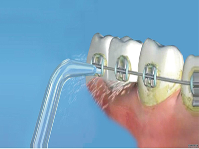 2023廣州娜高假體豐胸權(quán)威醫(yī)生排行TOP10強(張華忠、肖文靚、陳敏亮技術(shù)信得過！)