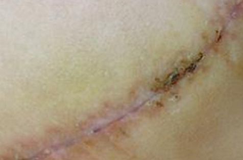 重慶去斑好的醫(yī)院哪家好？權(quán)威推薦，告訴您重慶著名的去斑治療醫(yī)院!