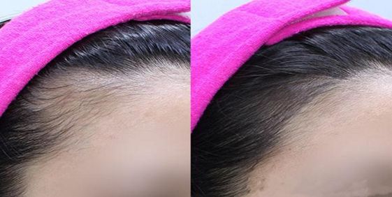 安陽民營整形醫(yī)院排名前三，哪家效果好的口碑最佳？