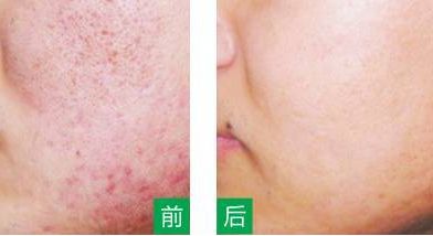 永州美辰醫(yī)療整形醫(yī)院的價(jià)格如何？收費(fèi)標(biāo)準(zhǔn)透明公開，術(shù)前注意事項(xiàng)必看！