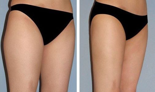 北京好的豐面部醫(yī)院哪家好？口碑最佳推薦！