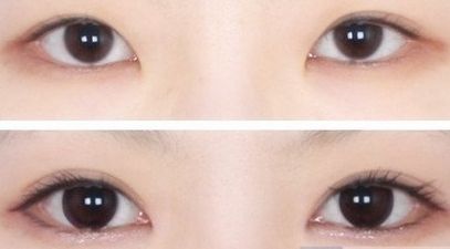 ?？谧雎”轻t(yī)院哪家好？?？谀募艺葆t(yī)院的鼻部整形效果好且口碑贊？