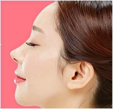 2023杭州抽脂冷凍溶脂排名榜TOP10的醫(yī)生(馮應(yīng)宏、陳鳴琦、高壽松值得信賴的選擇！)