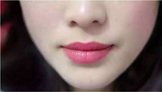 2023阜陽腹部除皺口碑榜前十位的專家(楊海平、江天明、蔡光浩深入網(wǎng)友傾心)