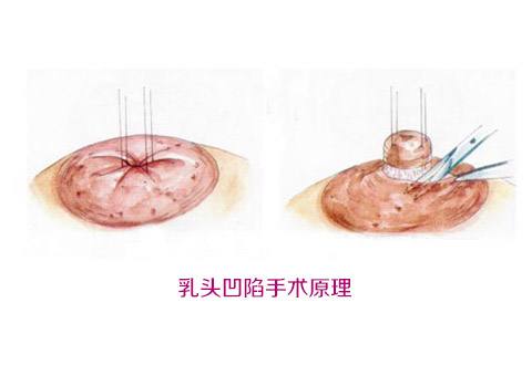 揭秘北京大學(xué)深圳醫(yī)院整形外科名醫(yī)團隊！想了解吸脂案例嗎？來看這里！