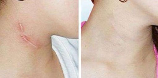 南京整形醫(yī)院哪家好又實惠？全面評估南京整容手術價格與口碑