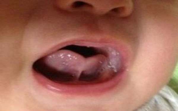 2023廣安光波祛雀斑top10強(qiáng)的醫(yī)生(朱鴷、蔣朝華、蔣朝華真實(shí)口碑橫評(píng)分享)